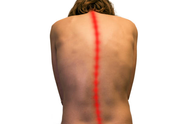 脊椎側彎如何辨別與處置｜台中物理治療｜美式整脊｜美式整復