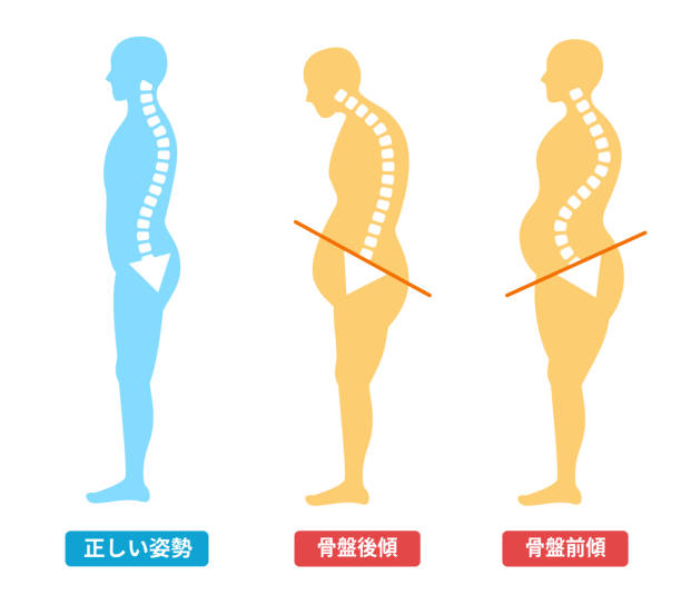 骨盆歪斜(前傾、後傾)所引起的腰酸背痛！透過徒手物理治療，改善骨盆歪斜與腰背痛！｜台中喬骨盆｜骨盆功能性調整